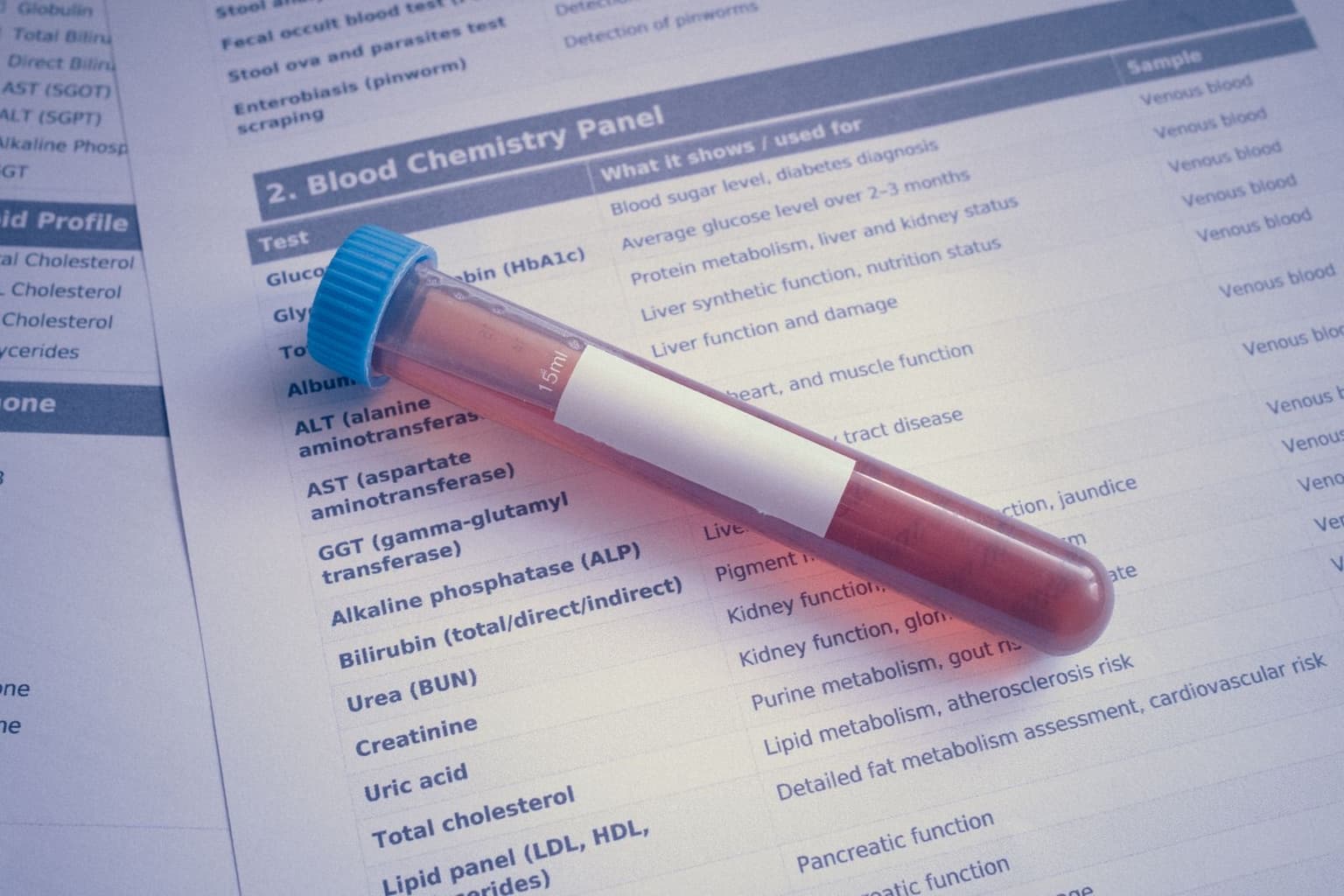 A capped blood sample tube resting on a printed blood chemistry panel listing test names